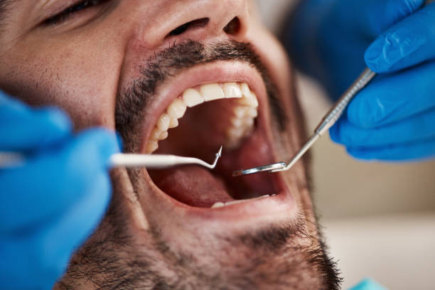 Best Emergency Denture Repair in Lansing, MI
